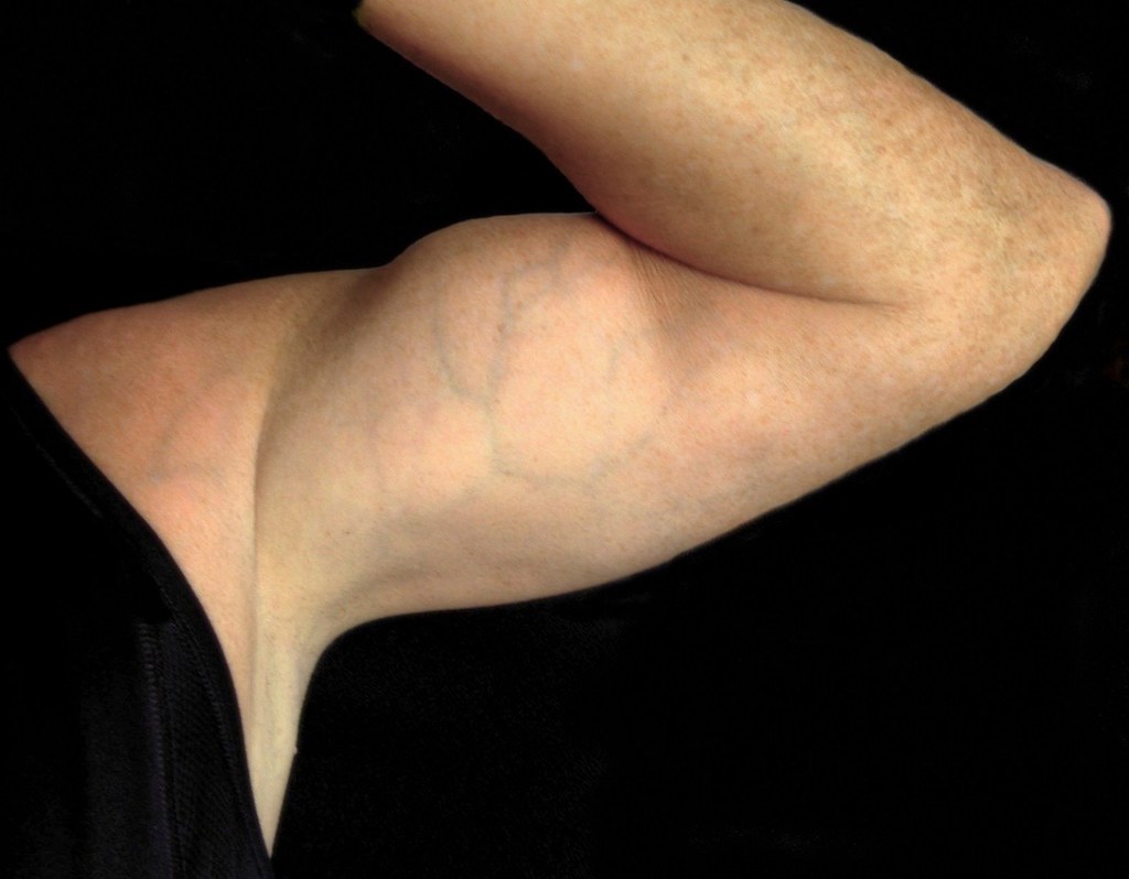 Dias de costas e bíceps: Maximizando Seus Ganhos Musculares